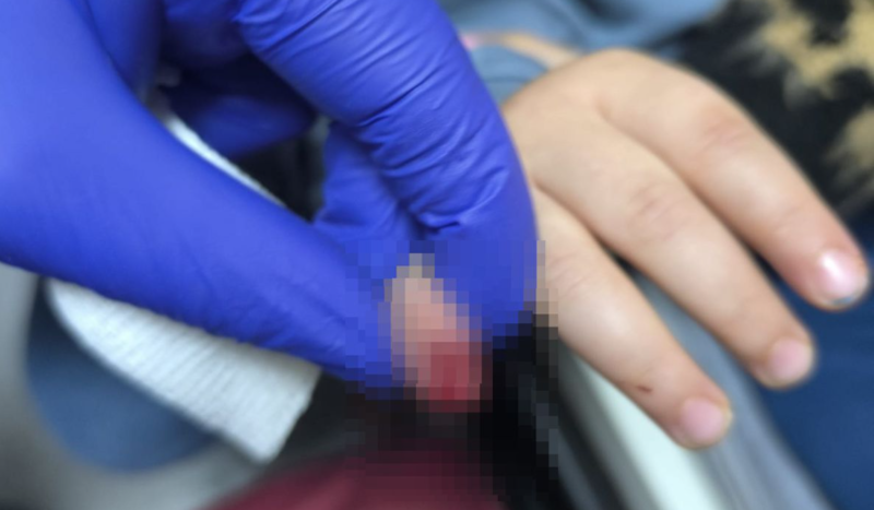 Eskalatora əli ilişən 3 yaşlı uşağın barmağı qopdu - VİDEO