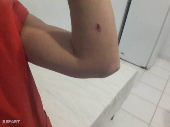 Azərbaycanda qadınlar arasında bıçaqlı i̇nsi̇dent – yaralanan var – foto