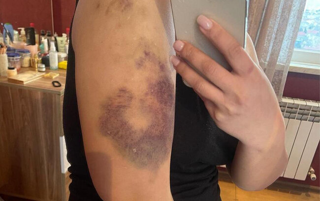 Eks-sevgilisindən Hidayətə ittihamlar - "550 min pulumu ələ keçirib, məni dəfələrlə döyüb"