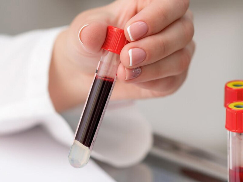 Alimlər süni qan qrupu yaratdı