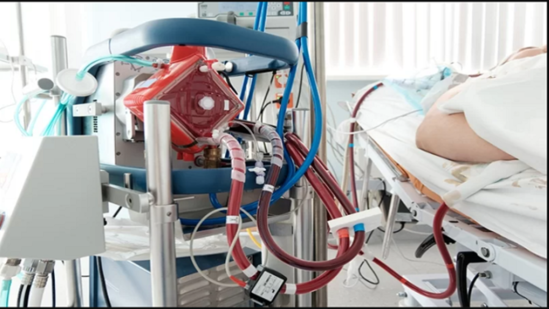 Baş direktorun vəziyyəti ağırlaşdı, süni tənəffüs aparatına qoşuldu