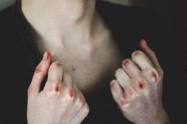 Bakıda sərxoş kişi arvadını dabankeşlə döyüb