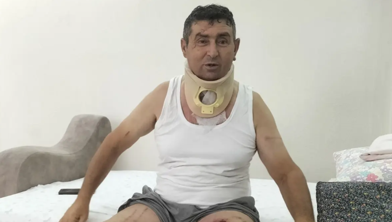 Zooparkdan qaçan aslanın hücumuna məruz qalan kişi: "Bu hadisədə yalnız mən və aslan günahsızıq"