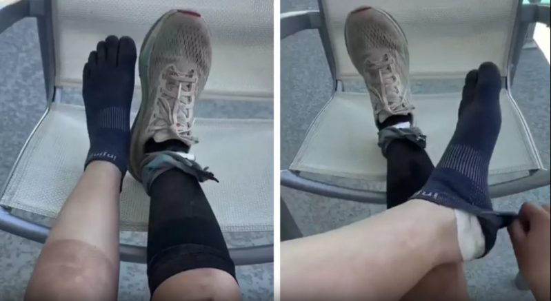 160 kilometrlik ultramarafonu tamamlayan idmançının ayaqlarının son görüntüsü gündəm oldu - VİDEO