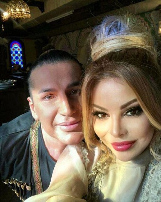 Müğənni Samir Bağırov illər sonra üzə çıxdı - FOTOLAR