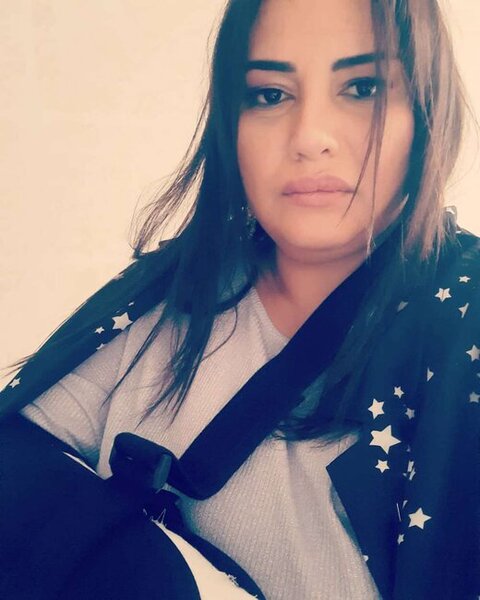 Azərbaycanlı aparıcı biləyini sındırdı - Fotolar