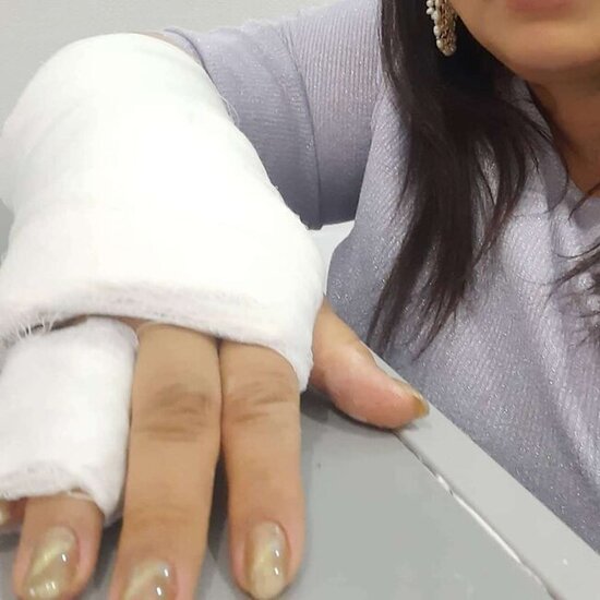 Azərbaycanlı aparıcı biləyini sındırdı - Fotolar