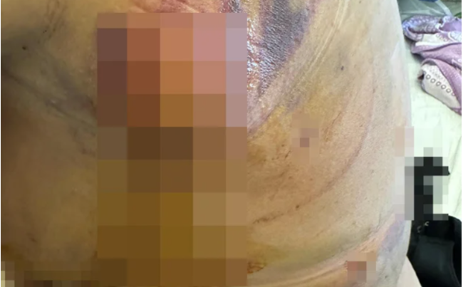 "Könül Ağamirova məni 3 dəfə əməliyyat edib pis vəziyyətə qoydu" (FOTO)