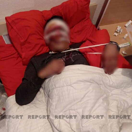 Cəlilabadda ağır yol qəzası baş verib, xəsarət alanlar var