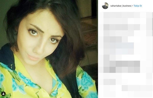 Coliye bənzəmək üçün onlarla əməliyyat etdirən fenomenin 10 il öncəki ŞOK HALI - FOTOLAR