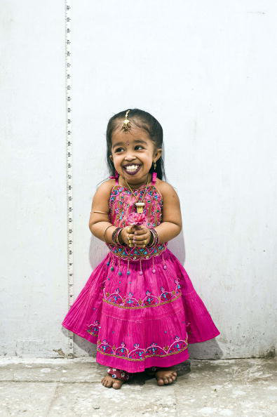 Dünyanın ən balaca boylu qızını sizdə tanıyın- VİDEO-FOTOLAR