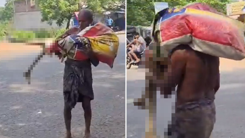 Bank rəsmi ölüm sənədi istədi, səhv anlayıb qardaşının sümüklərini apardı