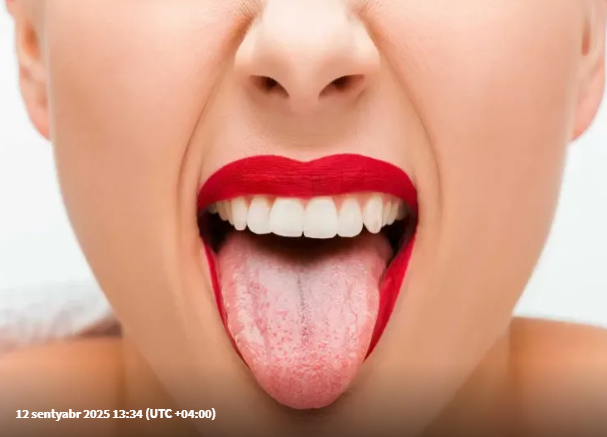 Dil vasitəsilə hansı xəstəlikləri "diaqnoz" etmək olar?