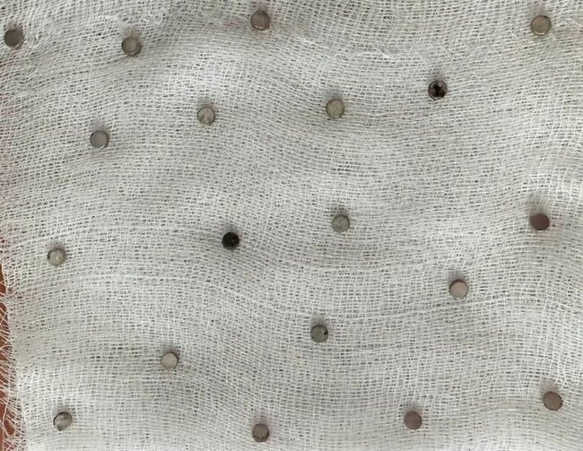 3 yaşlı uşağın boğazından 19 maqnit çıxarıldı