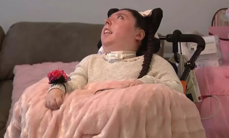 Beyni olmadan doğuldu, artıq 20 yaşını qeyd edir