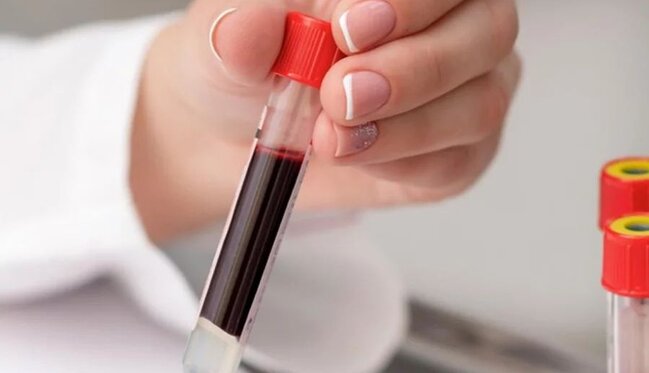 Bu qan qrupundan olanlara XƏBƏRDARLIQ