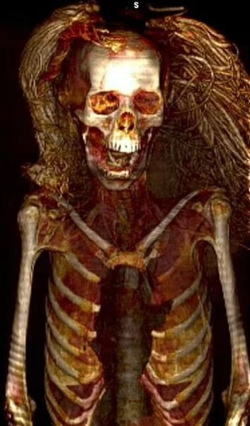 3500 il əvvəl yaşamış "Qışqıran qadın": Orqanları hələ də YERİNDƏDİR - FOTOLAR