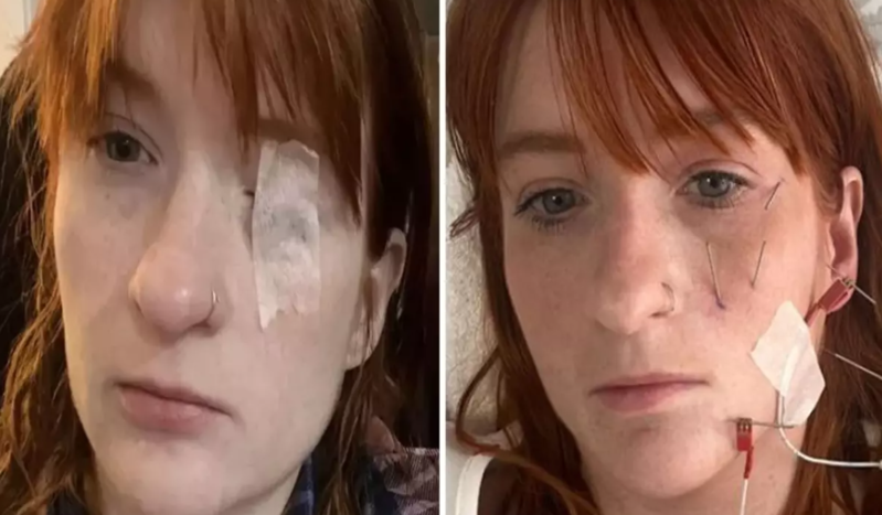 30 yaşlı qadın doğuşdan sonra çay içdi, həyatı kabusa döndü