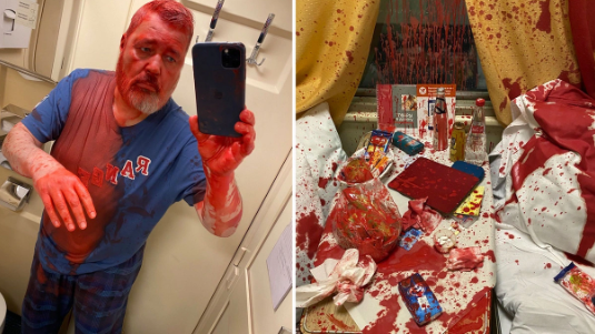 Nobel mükafatı laureatı olan jurnalistə boyalı hücum