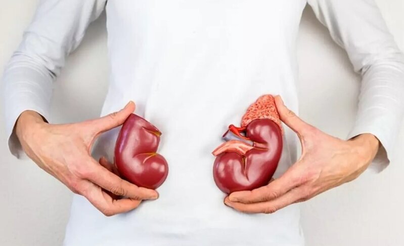 Ağrısının səbəbini böyrək daşı sandı, həqiqət isə tamam fərqli çıxdı