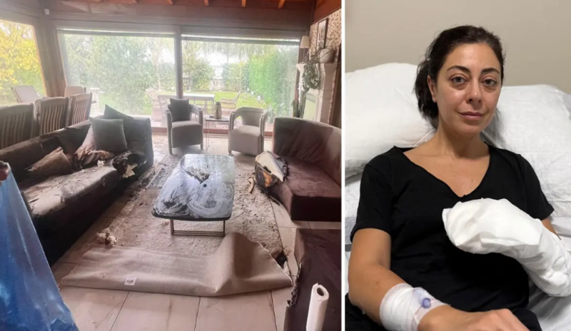 Evinə aldığı dekor, bədəninin 30 faizinin yanmasına səbəb oldu - VİDEO