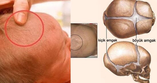 Körpələri bu yersiz müalicələrə məruz qoymayın - Tanınmış pediatrdan MƏSLƏHƏTLƏR