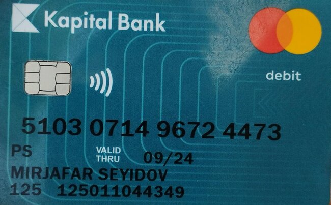 "Mərhəmətli insanlar, yeganə balamı ölməyə qoymayın" - 2 yaşlı Mirsəccadın YARDIMA ehtiyacı var - FOTO/VİDEO