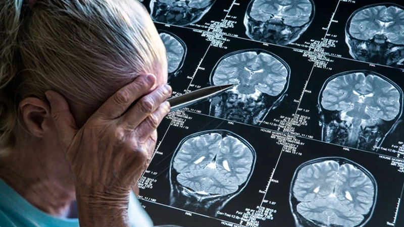 Altsheymer tarixə qovuşur? - Bu il öyrəndiyimiz ümidverici beş yenilik