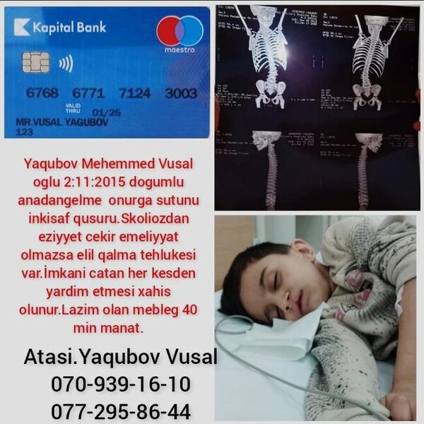 Bu uşağın yardımınıza ehtiyacı var - FOTO