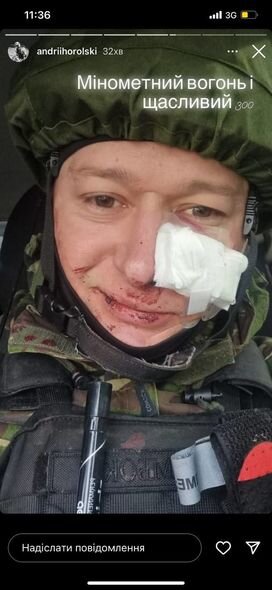 Könüllü olaraq ölkəsini müdafiə edən ukraynalı musiqiçi yaralanıb - FOTO