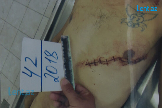 Vidadi Bərdəlinin oğlunun CİNAYƏT İŞİ: "Nərminlə olanda..." - VİDEO