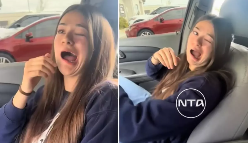 Gənc qadının birdən-birə ağzı əyilməyə başladı – Səbəb görün nə çıxdı - VİDEO