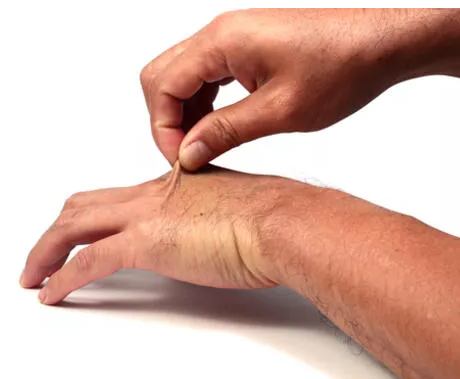 Arvadını çimdiklədiyinə görə boşadılar