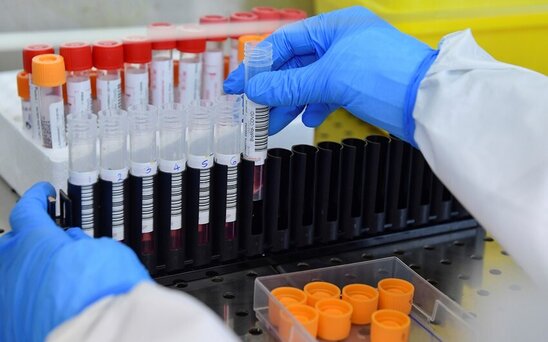 İtaliyada koronavirusun "omikron-2" ştamı aşkarlanıb