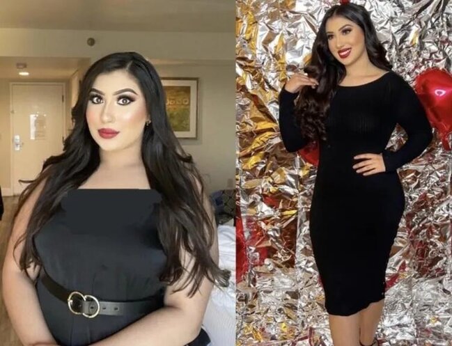 Ac qalmadan 23 kilo verdi: "Sadəcə hər yeməyin yanında bunu yeyirdim" - FOTO