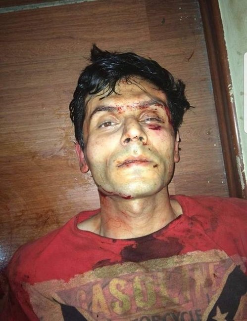 İcra başçısını güllələyən Yunisin ŞOK fotosu yayıldı - DİN-dən AÇIQLAMA