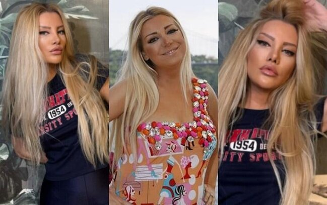 9 saatlıq estetik əməliyyatdan sonra BELƏ OLDU - FOTOLAR