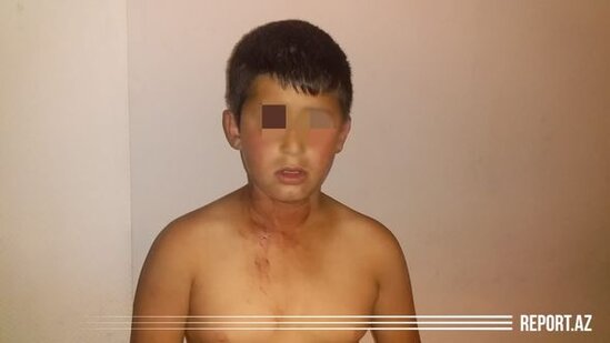 Bakıda ata dilənmək istəməyən 11 yaşlı oğlunu başından bıçaqladı - FOTO
