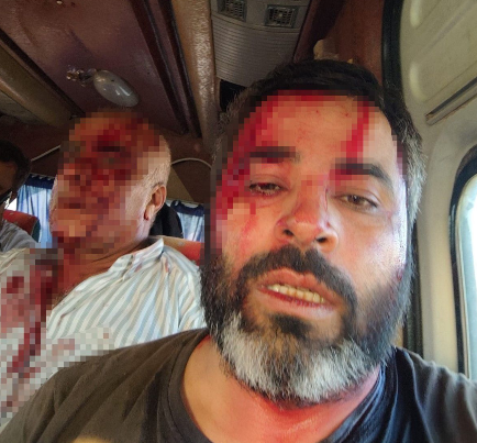 Torpaq mübahisəsi qanlı davaya çevrildi: 8 nəfər xəsarət aldı
