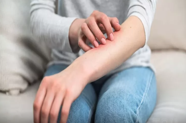 Dəriniz hissə-hissə soyulur: Necə müalicə etmək olar?