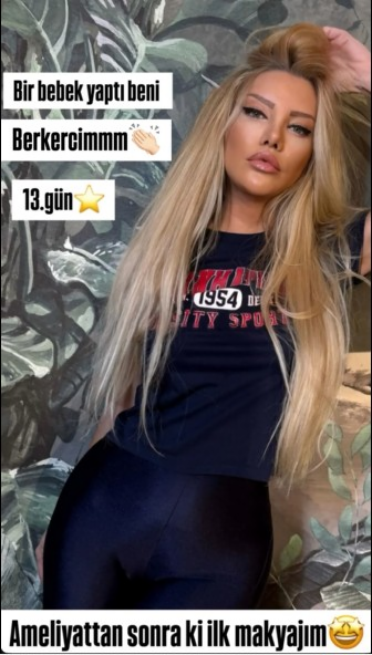 9 saatlıq estetik əməliyyatdan sonra BELƏ OLDU - FOTOLAR