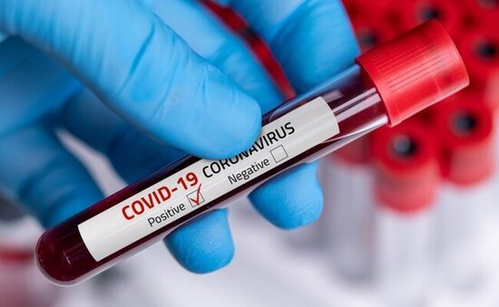 Son sutkada yoluxanların sayı