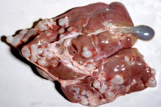 Dönərdən yoluxa biləcəyiniz dəhşətli xəstəlik - Fotolar