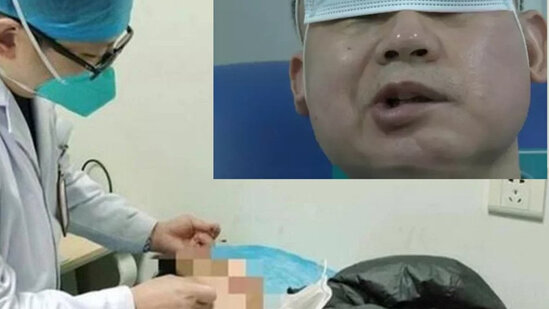 Dünya Çempionatına görə yuxusuz qalan adam üz iflici oldu