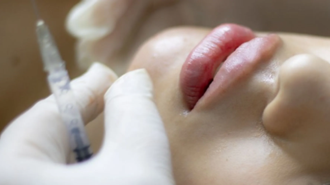 Bakıda dodaq dolğusu etdirən qadının başına iş gəldi