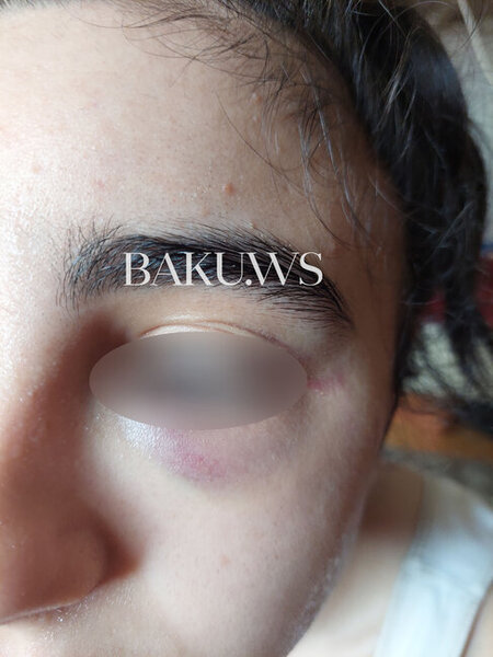 Bakı məktəbində sinif yoldaşları məktəbli qızı vəhşicəsinə döydülər - FOTO/VİDEO