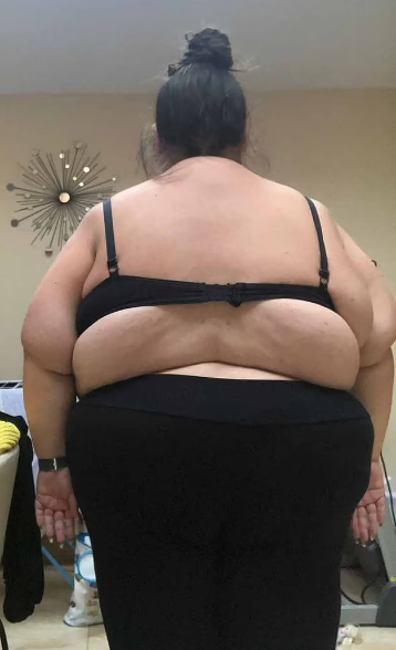 Qorxudan 122 kiloqram arıqladı - FOTOLAR