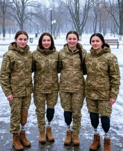 Ayaqlarını itirən bu qızlar bəlkə də dünya gözəlləri seçilərdilər... - FOTO