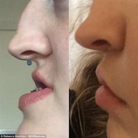 Hər kəs onu lağa qoyurdu, indiki halını görənlər şokda - FOTOLAR