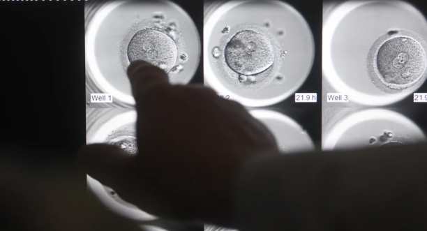 Süni mayalanma qadın sağlamlığını məhv edir? - Rusiyalı həkimdən AÇIQLAMA